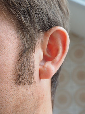 Jak wygląda prawidłowa higiena uszu?
